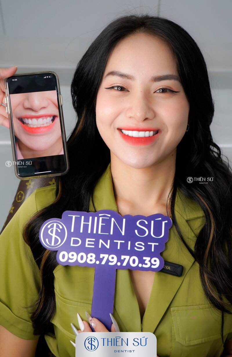 d&aacute;ng răng sứ đẹp
