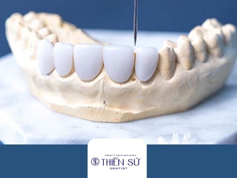 răng sứ sử dụng được bao l&acirc;u