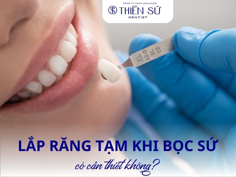 lắp răng tạm khi bọc sứ c&oacute; cần thiết kh&ocirc;ng
